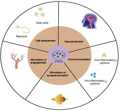 Induced Pluripotent Stem Cells for Ischemic Stroke Treatment